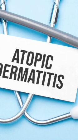 Atopic dermatitis &#8211; Symptoms and management tips