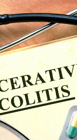 Simple tips for managing ulcerative colitis